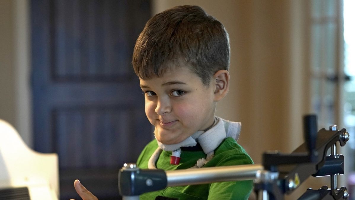 Paralyzing Disease, virus , disease , metropolis, enterovirus, vaccine