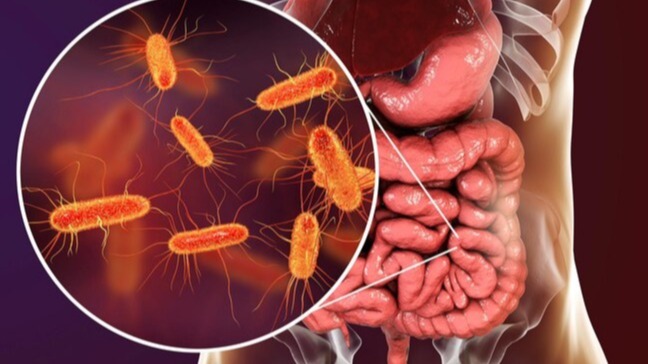 Intestine Bacteria, Biomedical Sciences, Researchers , rotavirus infection, microorganism