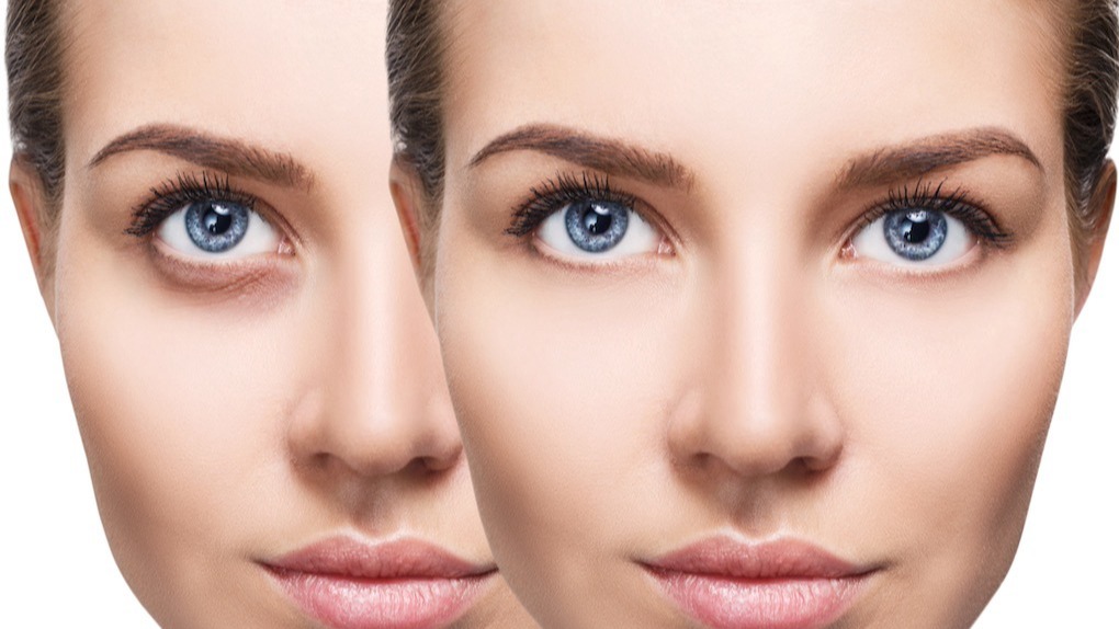 dark circle, water, skin, sleep, oil, tea bags