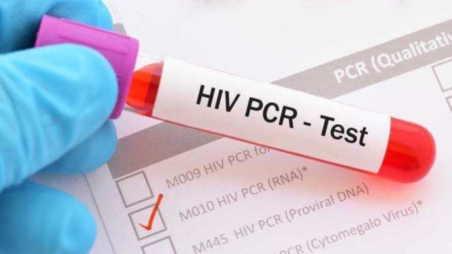 DIY tests , Covid-19, coronavirus, human-papillomavirus , HPV Tests