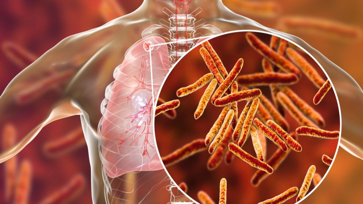 Scleroderma, clinical, systemic sclerosis, pathogenic , skin