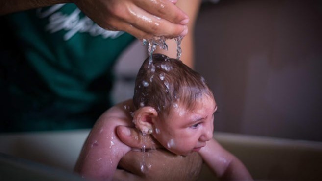 Zika virus , Risk of autism, neurological, South Asia, Eye