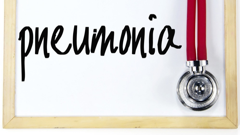 covid-19 , pneumonia, virus, influenza,  t cells, viruses ,  microorganisms