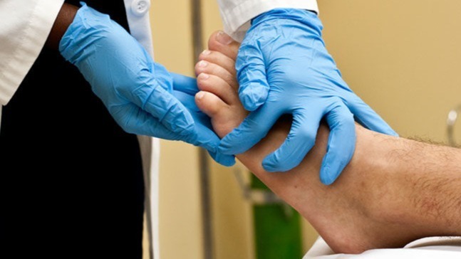 coronavirus, Covid tongue, symptoms, Epidemiologists,  ophthalmologists