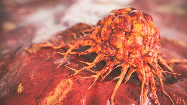 three-D ,  subculture fashion, petri dish, Cancer,  Immune Gadget, TUMOR