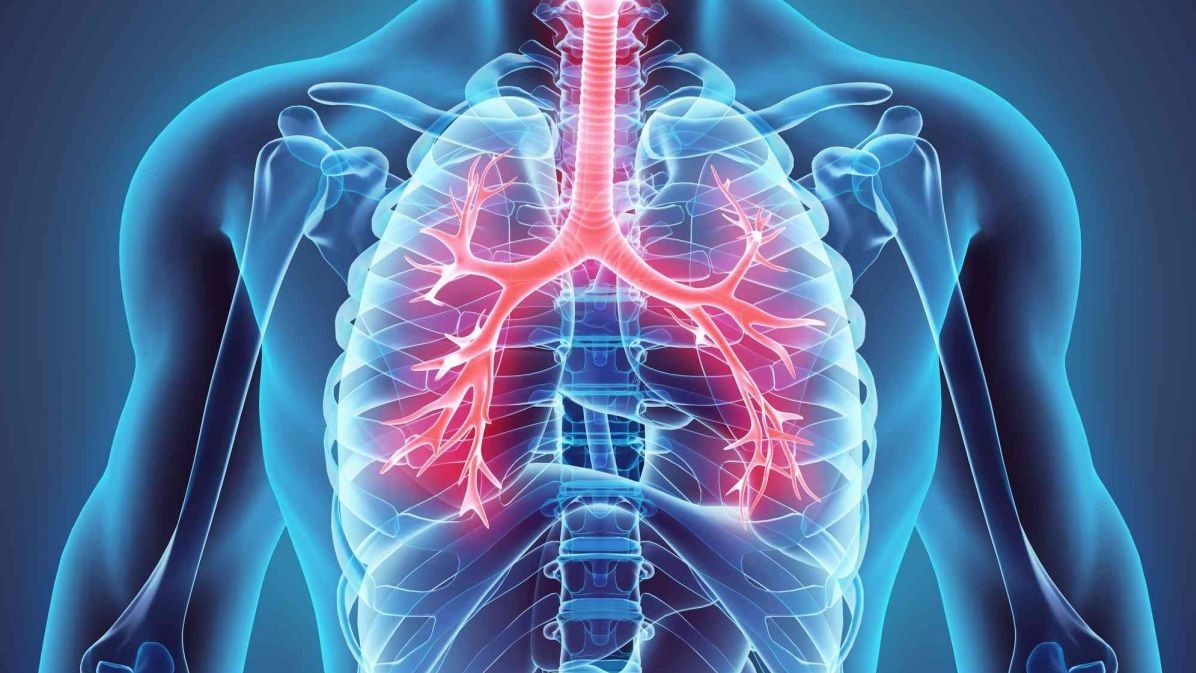 technique ,  ultra-high ductility , non-biodegradable metal, Pediatric laryngotracheal stenosis , biology