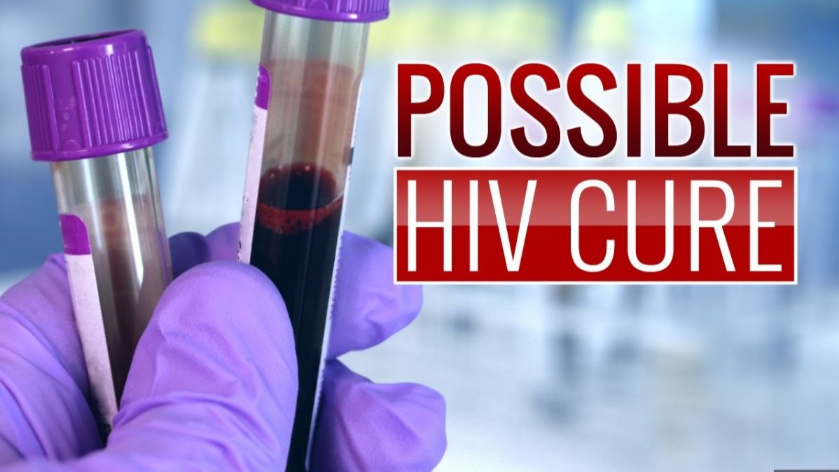 human immunodeficiency virus , lung infection, cells ,  cd8 lymphocytes, Healing Breakthrough