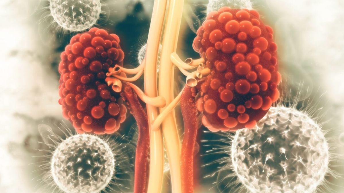 polycystic kidney , sickness , discover ,  pharmacy , biomolecular sciences