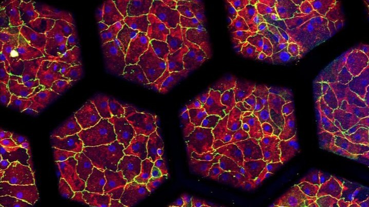 lung , medicines , thoracic surgical,  treatment, Helmholtz center,  disease, microenvironment