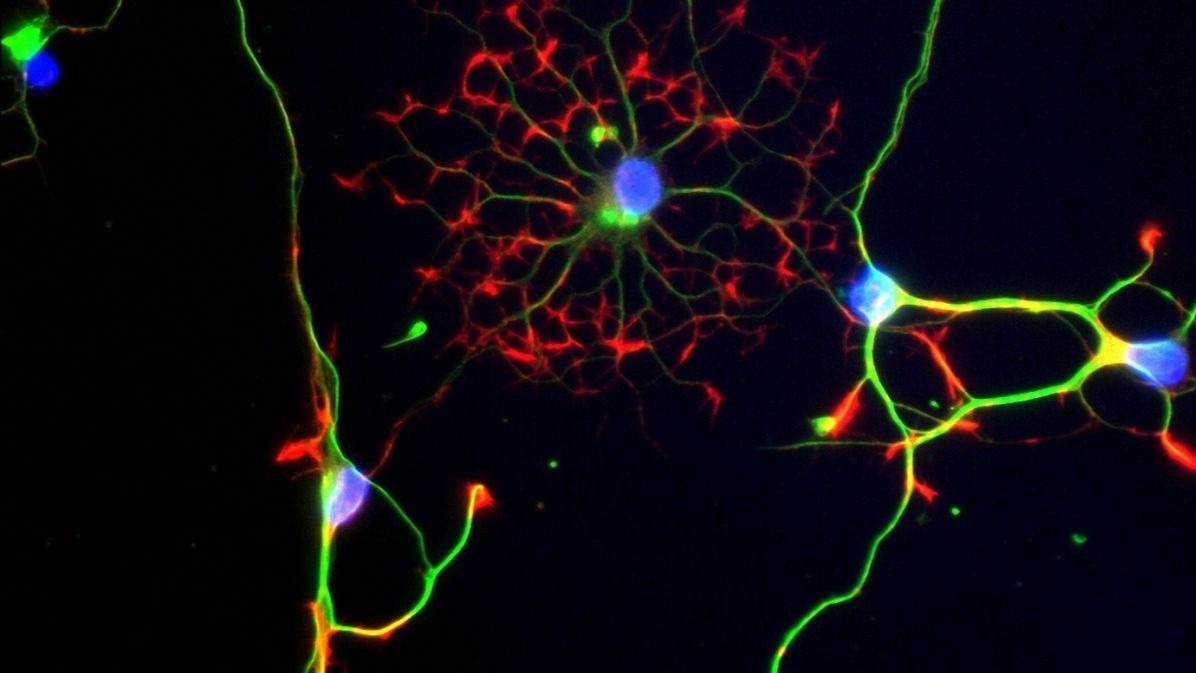 brain , stem cells, genetic disorders, pills, tissue-unique, blood-mind