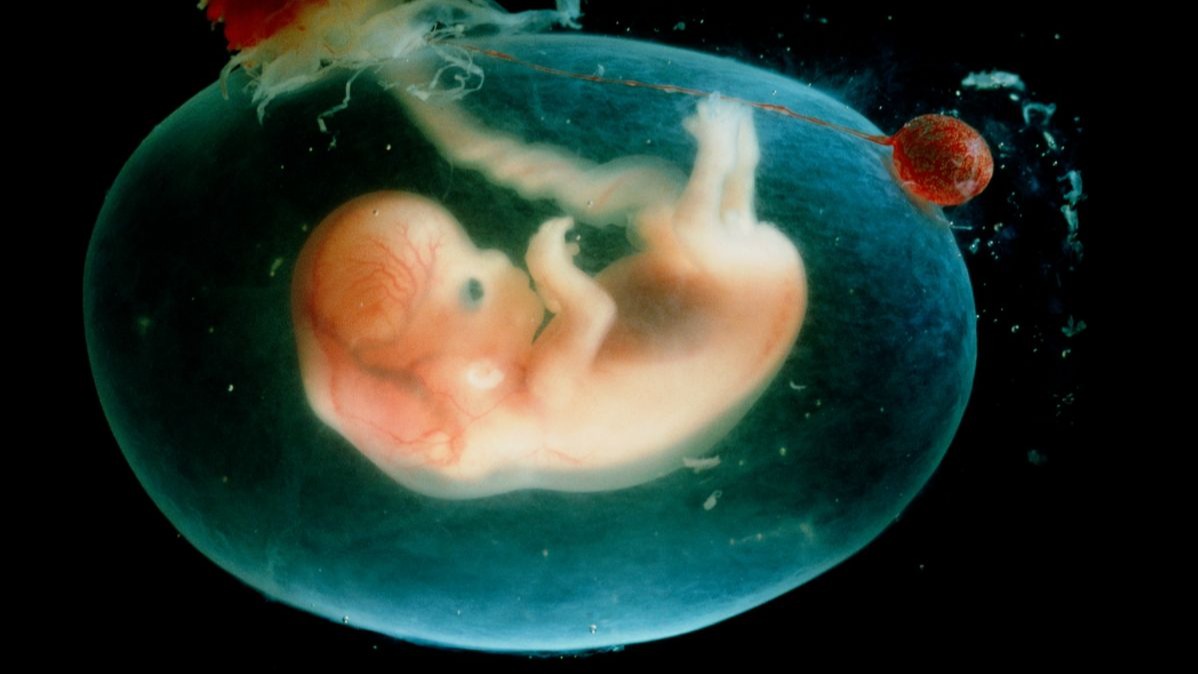 tissue infection, physiological tissue, epithelial phagocytosis, techniques , Immune Reaction