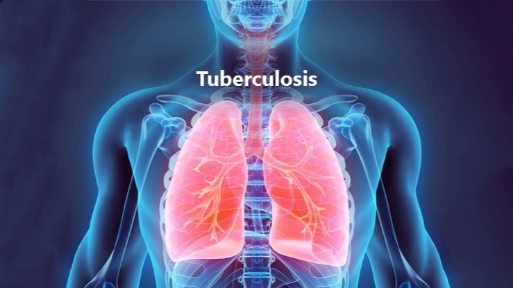 numerous diseases , disorder , microorganism , interferons, TB