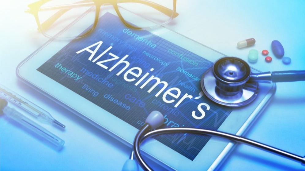 Alzheimer's sickness, arrhythmia, disorder,  Fitness care, diagnostic tactics