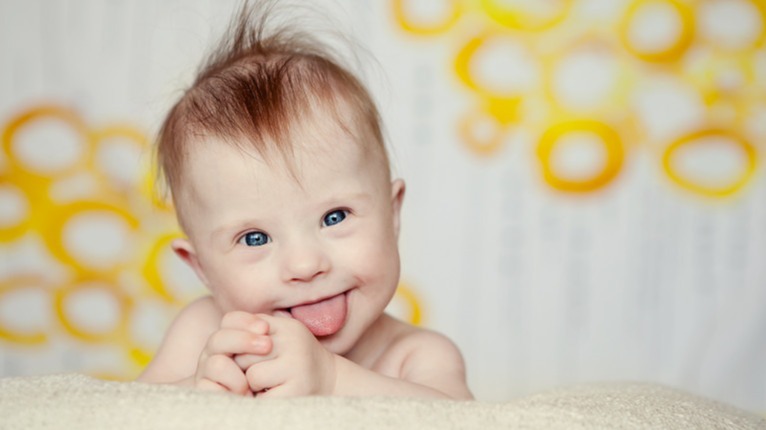 worldwide , down syndrome, Costa, English,  Spanish,  French,  Italian,  Portuguese,  German,  Bengali