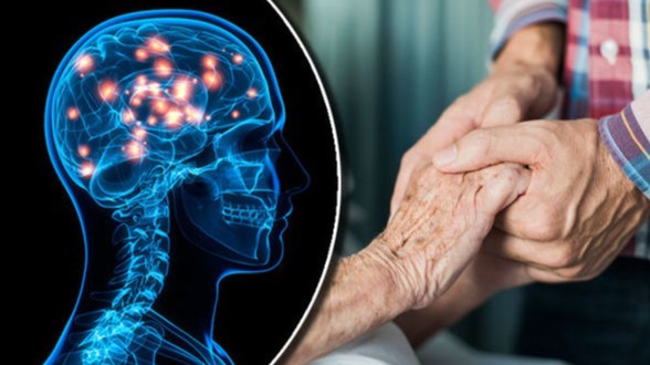 disease, genetic sickness, DNA, Huntington's disorder, neuroscience