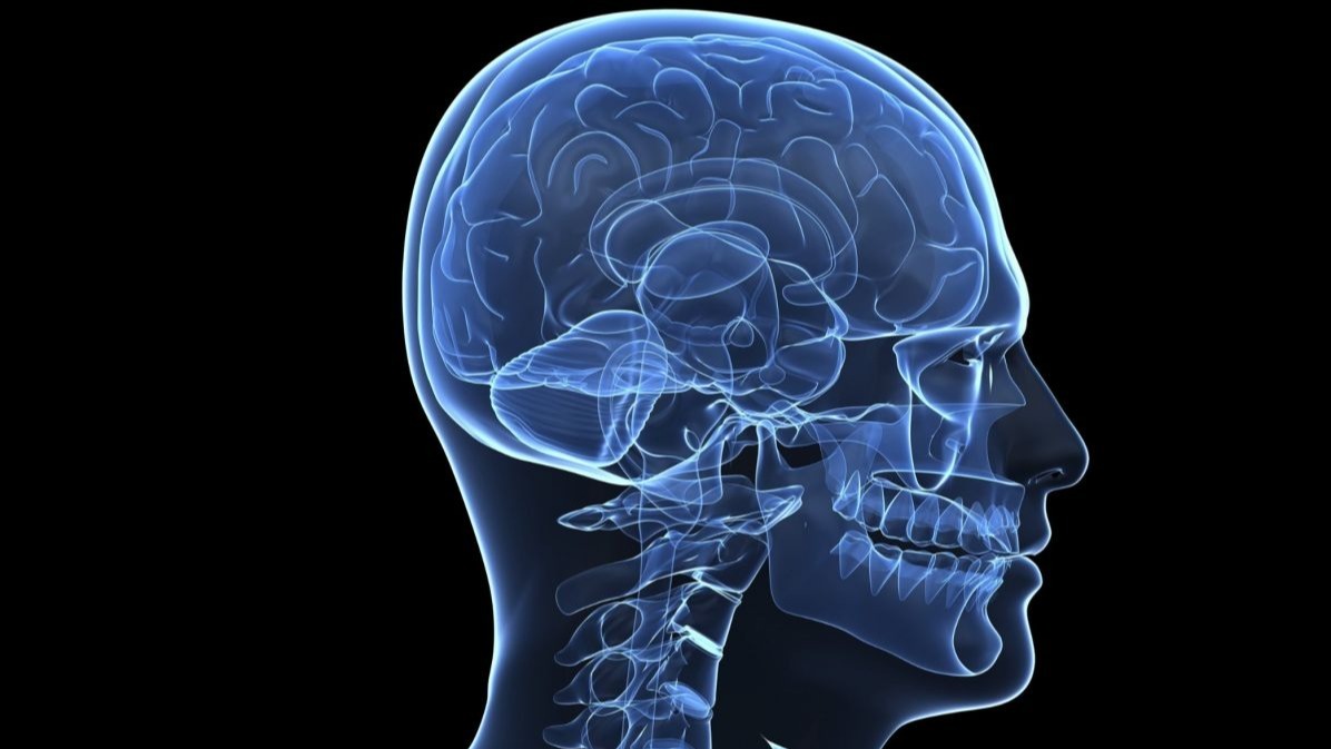 cochlear implants , degree, fibers , tonotopic ,  x-ray