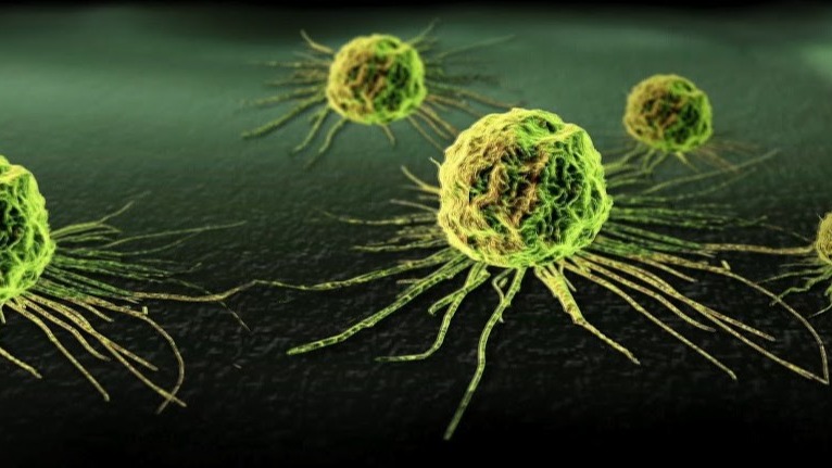 vegf-c,  mesenchymal cells,  epithelial cells,  drugs,  medical, Breast cancer