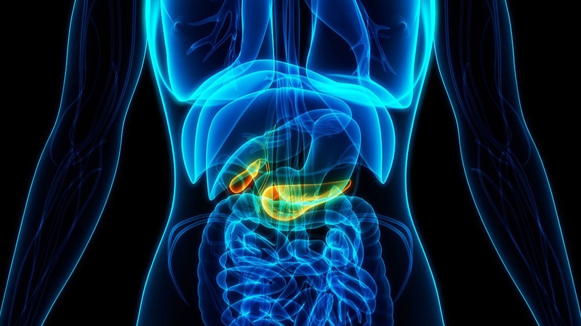cancer , stroma , pancreatic tumors, macropinocytosis , fibrotic tissue