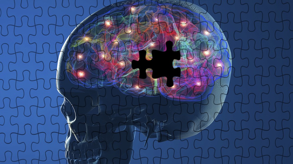 Parkinson's disease, Amyloid Link, premelanosomal, diseases, melanoma cells