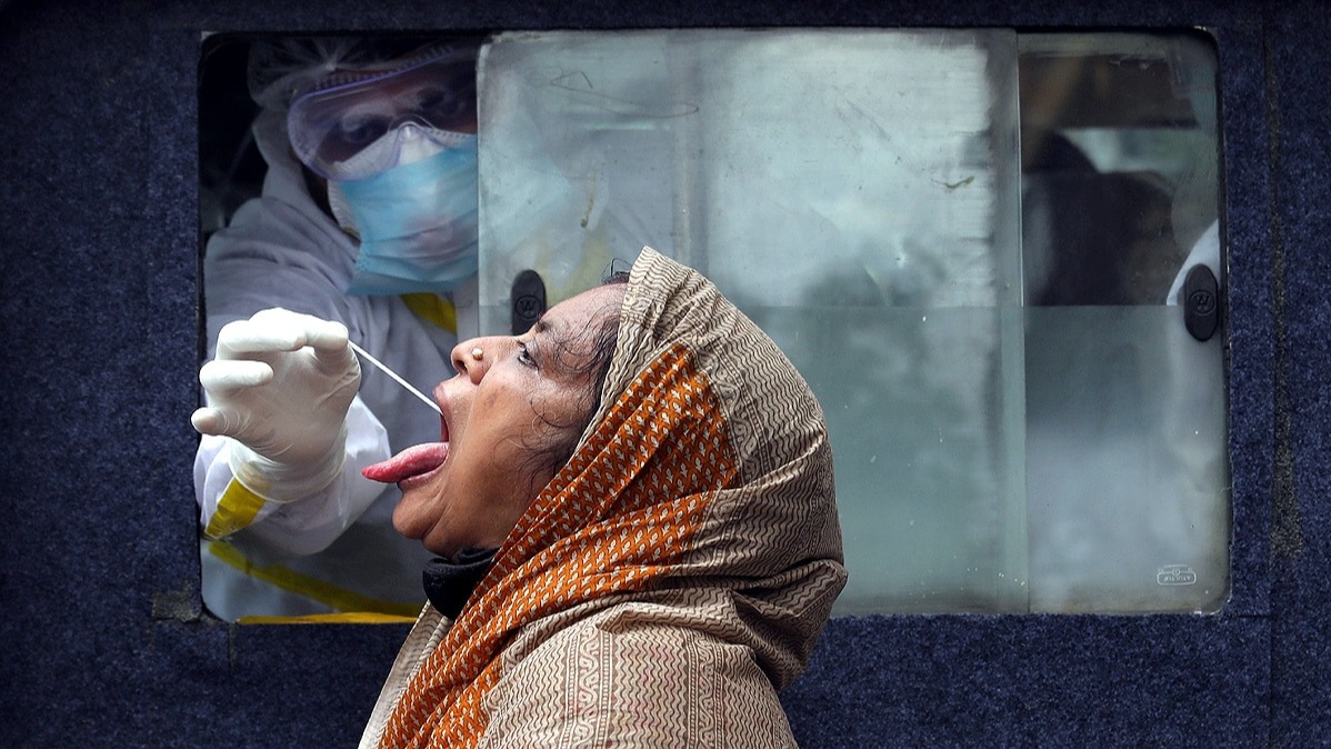 Akshay Nair, diabetic, mucormycosis, covid-19, fungus