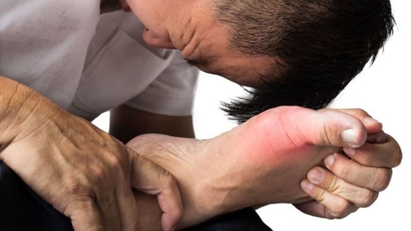 gout, types of gout, treatment of gout,  drugs used in gout, acute gout, chronic gout